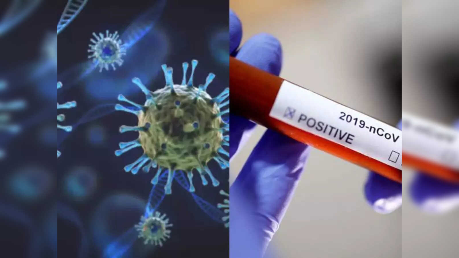 Corona Virus: దేశంలో పెరుగుతున్న కరోనా కేసులు.. కొత్త వేరియంట్లతో దడ 